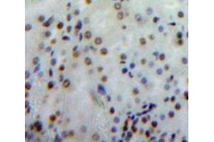 Used in DAB staining on fromalin fixed paraffin-embedded Kidney tissue (Merlin antibody  (AA 30-239))
