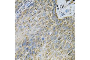 Immunohistochemistry of paraffin-embedded human esophagus using  Antibody (ABIN6127328, ABIN6136696, ABIN6136697 and ABIN6217467) at dilution of 1:100 (40x lens). (Adenylate Kinase 1 antibody  (AA 1-194))