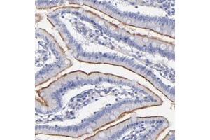 Immunohistochemical staining of human small intestine with SLC44A2 polyclonal antibody  shows membranous positivity in glandular cells.