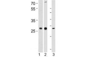 Western blot analysis of 1) human CEM, 2) rat PC-12, and 3) mouse spleen tissue lysate using LIF antibody at 1:1000. (LIF antibody  (AA 72-101))