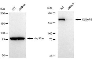 anti-IQ Motif Containing GTPase Activating Protein 2 (IQGAP2) antibody