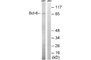 Western blot analysis of extracts from 293 cells, using Bcl-6 (Ab-333) antibody. (BCL6 antibody  (Ser333))