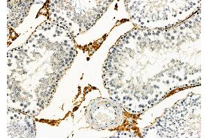 ABIN6258168 and ABIN6273861 at 1/100 staining Rat testis tissue by IHC-P. (GPR21 antibody  (Internal Region))