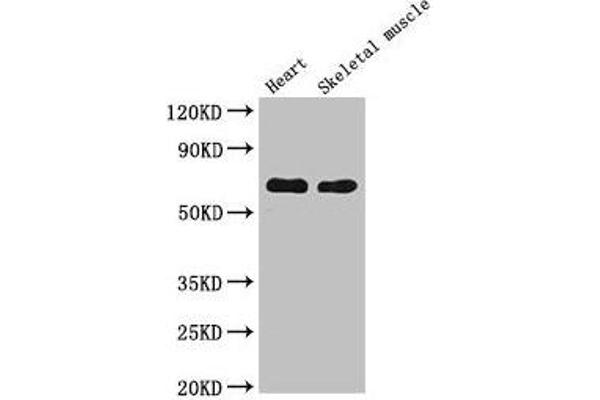 CES1 anticorps  (AA 291-566)