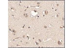 Immunohistochemistry of Slitrk3 in human brain tissue with this product at 2. (SLITRK3 antibody  (C-Term))