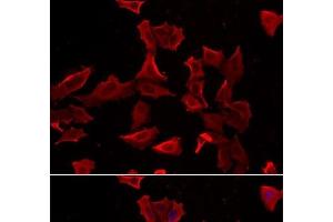 ADSS antibody