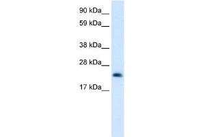 WB Suggested Anti-HMGB3 Antibody Titration:  0. (HMGB3 antibody  (C-Term))