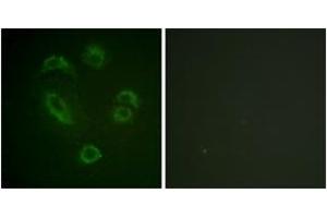 Immunofluorescence analysis of A549 cells, using DAPP1 (Phospho-Tyr139) Antibody. (DAPP1 antibody  (pTyr139))