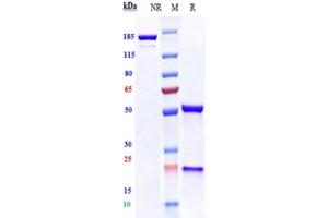 Anti-VEGFR2 / KDR / CD309 Reference Antibody (Imclone 6.
