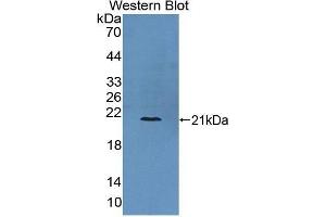 Western Blotting (WB) image for anti-Collagen, Type VI, alpha 3 (COL6a3) (AA 463-624) antibody (ABIN1867320) (COL6a3 antibody  (AA 463-624))