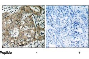 Image no. 2 for anti-Forkhead Box O1 (FOXO1) (Ser319) antibody (ABIN197367) (FOXO1 antibody  (Ser319))
