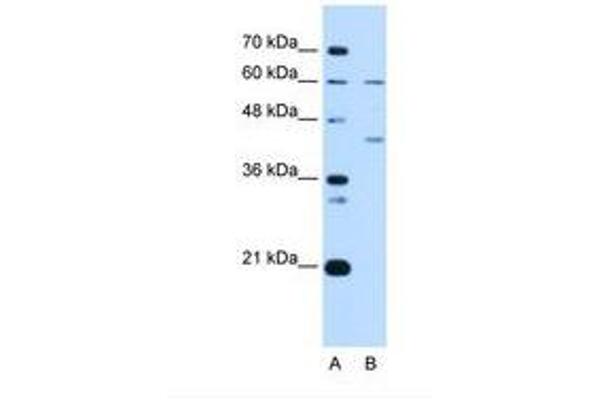 RFC5 antibody  (N-Term)