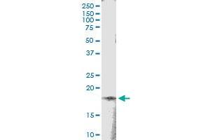 Immunoprecipitation of TSEN15 transfected lysate using anti-TSEN15 MaxPab rabbit polyclonal antibody and Protein A Magnetic Bead , and immunoblotted with TSEN15 MaxPab mouse polyclonal antibody (B01) . (TSEN15 antibody  (AA 1-171))