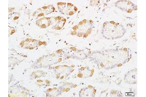 Formalin-fixed and paraffin embedded rat kidney tissue labeled with Anti-PRKD3 Polyclonal Antibody, Unconjugated (ABIN754678) at 1:200 followed by conjugation to the secondary antibody and DAB staining
