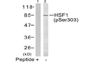 Image no. 2 for anti-Heat Shock Factor Protein 1 (HSF1) (pSer303) antibody (ABIN197024) (HSF1 antibody  (pSer303))