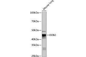 Western blot analysis of extracts of Mouse lung, using DDB2 Rabbit mAb (ABIN7266674) at 1:1000 dilution. (DDB2 antibody)