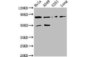 Western Blot Positive WB detected in: Hela whole cell lysate, A549 whole cell lysate, U251 whole cell lysate, Mouse lung tissue All lanes: Pcsk1 antibody at 8 μg/mL Secondary Goat polyclonal to rabbit IgG at 1/50000 dilution Predicted band size: 85 kDa Observed band size: 85 kDa (PCSK2 antibody  (AA 267-391))