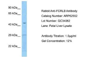 Western Blotting (WB) image for anti-Fc Receptor-Like B (FCRLB) (N-Term) antibody (ABIN2789176) (FCRLB antibody  (N-Term))