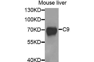 Western blot analysis of extracts of mouse liver, using C9 antibody. (C9 antibody)