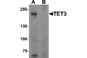 Western blot analysis of TET3 in SK-N-SH cell lysate with TET3 antibody at 1 µg/mL in (A) the absence and (B) the presence of blocking peptide.