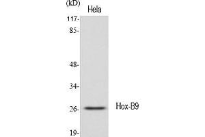 Western Blot analysis of various cells using Hox-B9 Polyclonal Antibody diluted at 1:1000. (HOXB9 antibody  (AA 180-260))