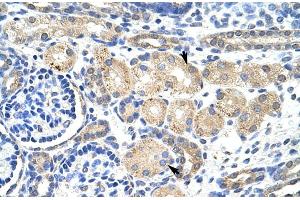Immunohistochemistry (IHC) image for anti-Potassium Voltage-Gated Channel, Shaker-Related Subfamily, beta Member 2 (KCNAB2) (Middle Region) antibody (ABIN2780205) (KCNAB2 antibody  (Middle Region))