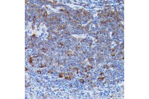 Immunohistochemistry (IHC) image for anti-Suppressor of Cytokine Signaling 3 (SOCS3) (C-Term) antibody (ABIN3021100)