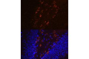 Immunofluorescence (IF) image for anti-Microtubule-Associated Protein tau (MAPT) (pThr231) antibody (ABIN7268531)