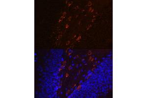 Immunofluorescence analysis of mouse brain using Phospho-Tau-T231 antibody (ABIN7268531). (MAPT antibody  (pThr231))