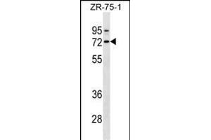 SELE Antibody (Ascites) ABIN1539992 western blot analysis in ZR-75-1 cell line lysates (35 μg/lane). (Selectin E/CD62e antibody)