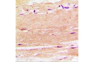 Immunohistochemistry (IHC) image for anti-Sphingosine Kinase 1 (SPHK1) antibody (ABIN7308364) (SPHK1 antibody)