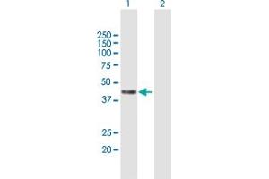 Western Blot analysis of PCMTD1 expression in transfected 293T cell line by PCMTD1 MaxPab polyclonal antibody. (PCMTD1 antibody  (AA 1-357))