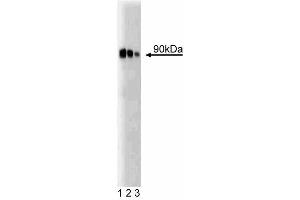 Western blot analysis of PKCepsilon on rat brain lysate. (PKC epsilon antibody  (AA 1-175))