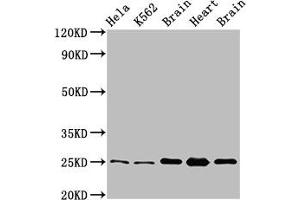 Western Blot Positive WB detected in: Hela whole cell lysate, K562 whole cell lysate, Rat brain tissue, Rat heart tissue, Mouse brain tissu All lanes: SOD2 antibody at 3. (SOD2 antibody  (AA 64-175))