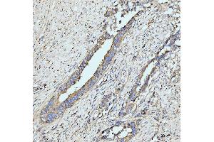 IHC analysis of GRPEL1 using anti-GRPEL1 antibody (ABIN7602643). (GRPEL1 antibody  (AA 90-217))