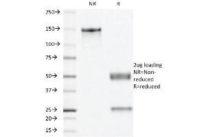 SDS-PAGE Analysis Purified PR Monoclonal Antibody (PR501). (Progesterone Receptor antibody)