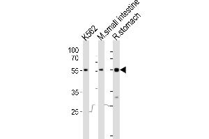 Western blot analysis of lysates from K562 cell line, mouse small intestine, rat stomach tissue lysate(from left to right), using Frk Antibody (C-term) (ABIN6243248 and ABIN6577654).