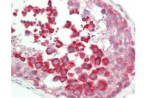 Human Testis: Formalin-Fixed, Paraffin-Embedded (FFPE). (TEX264 antibody  (AA 143-192))