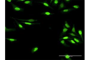 Immunofluorescence of purified MaxPab antibody to DDB2 on HeLa cell. (DDB2 antibody  (AA 1-427))