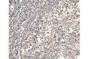 IHC analysis of Aldolase/ALDOA using anti-Aldolase/ALDOA antibody (ABIN7601908). (ALDOA antibody  (AA 50-364))
