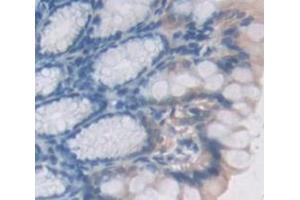 Figure. (GSTM2 antibody  (AA 5-202))