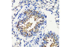Immunohistochemistry of paraffin-embedded mouse lung using FKBP12 antibody (ABIN3022503, ABIN3022504, ABIN3022505 and ABIN6218864) at dilution of 1:200 (40x lens). (FKBP1A antibody  (AA 1-108))