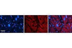 Rabbit Anti-ZYX Antibody    Formalin Fixed Paraffin Embedded Tissue: Human Adult heart  Observed Staining: Cytoplasmic (cytoskeleton) Primary Antibody Concentration: 1:600 Secondary Antibody: Donkey anti-Rabbit-Cy2/3 Secondary Antibody Concentration: 1:200 Magnification: 20X Exposure Time: 0.
