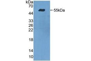 Detection of Recombinant ITGa9, Human using Polyclonal Antibody to Integrin Alpha 9 (ITGa9) (ITGA9 antibody  (AA 741-965))
