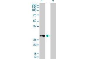 Lane 1: RAB33B transfected lysate ( 25. (RAB33B 293T Cell Transient Overexpression Lysate(Denatured))
