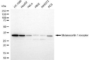 anti-Melanocortin 1 Receptor (MC1R) antibody