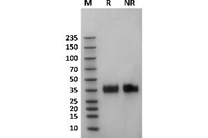 Human Fc gamma RIIa / CD32a (167H) protein on Coomassie Blue stained SDS-PAGE under non-reducing (NR) and reducing (R) conditions.