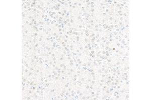 Immunohistochemistry (IHC) image for anti-Replication Protein A2, 32kDa (RPA2) (C-Term) antibody (ABIN7454599) (RPA2 antibody  (C-Term))