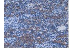 IHC-P analysis of Mouse Ovary Tissue, with DAB staining. (IL13RA2 antibody  (AA 228-338))