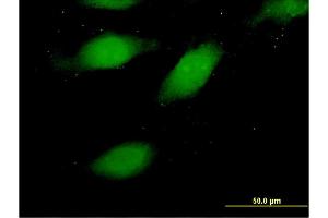 Immunofluorescence of monoclonal antibody to HMGA1 on HeLa cell. (HMGA1 antibody  (AA 1-107))